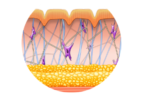 Skin laxity is caused by the loss of connective tissue due to the natural aging process & storage of excess fat.