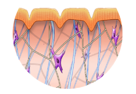 Uneven skin appearance caused by loss of collagen due to the natural aging process