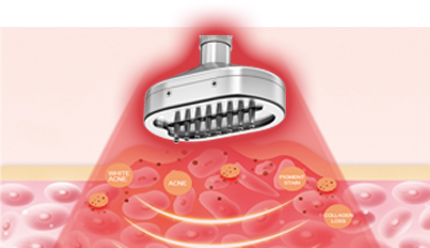 Bio Photoelectric Technology