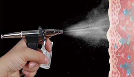 Oxygen Spray Gun Technology