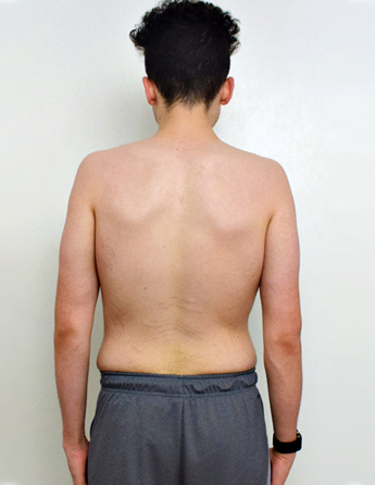 Back Fat Loss After