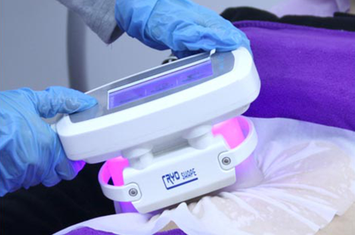 A portable cryolipolysis machine with fat-freezing cavitation tripolar RF and five-polar RF treatment