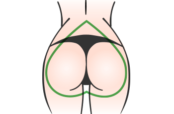 A-buttock