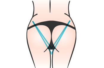 V-buttock